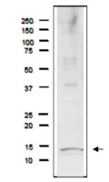 Rfa3/Rpa3 | Replication factor A protein 3 (Saccharomyces cerevisiae) in the group Antibodies Other Species / Fungi at Agrisera AB (Antibodies for research) (AS21 4551)